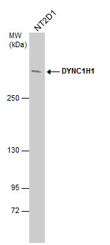 Anti-DYNC1H1 antibody used in Western blot. GTX101452