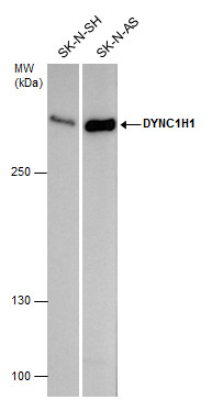 Anti-DYNC1H1 antibody used in Western blot. GTX101452