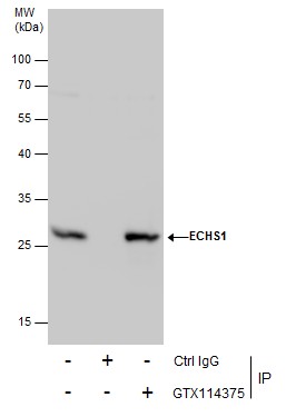 Anti-ECHS1 antibody used in Immunoprecipitation. GTX114375