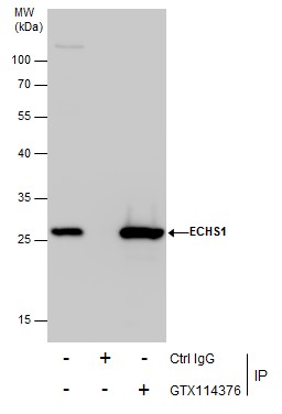 Anti-ECHS1 antibody [N1C2] used in Immunoprecipitation. GTX114376