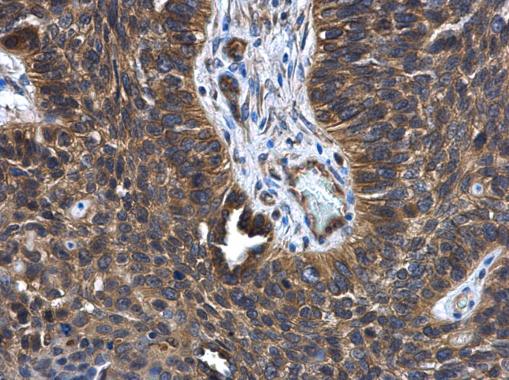 Anti-FGD4 antibody [N1N3] used in IHC (Formalin-fixed paraffin-embedded sections). GTX109859