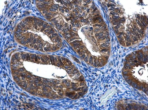 Anti-FGD4 antibody [N1N3] used in IHC (Formalin-fixed paraffin-embedded sections). GTX109859