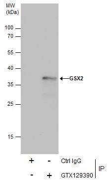 Anti-GSX2 antibody used in Immunoprecipitation. GTX129390