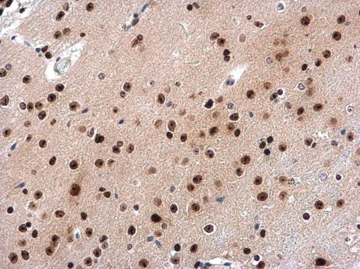 Anti-INTS4 antibody [N1N2], N-term used in IHC (Formalin-fixed paraffin-embedded sections). GTX116519