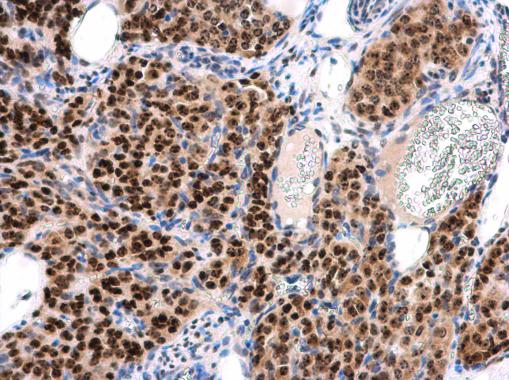 Anti-INTS4 antibody [N1N2], N-term used in IHC (Formalin-fixed paraffin-embedded sections). GTX116519
