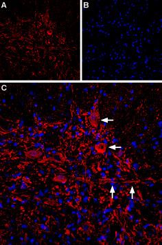 Anti-IP3 Receptor 2 antibody used in Immunohistochemistry. GTX54772