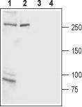 Anti-IP3 Receptor 2 antibody used in Western blot. GTX54772