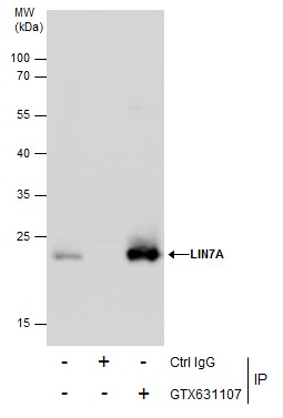 Anti-LIN7A antibody [GT879] used in Immunoprecipitation. GTX631107