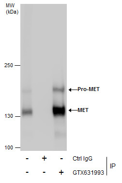 Anti-MET antibody [GT1586] used in Immunoprecipitation. GTX631993