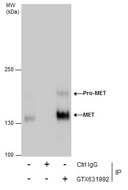 Anti-MET antibody [GT556] used in Immunoprecipitation. GTX631992