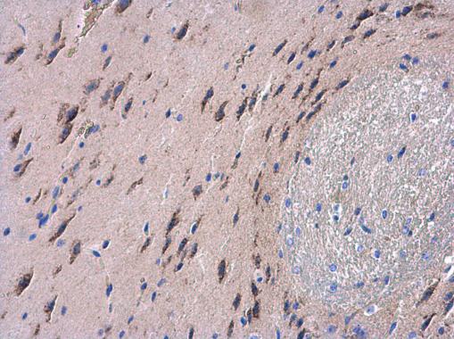 Anti-NDUFAB1 antibody used in IHC (Formalin-fixed paraffin-embedded sections). GTX111875