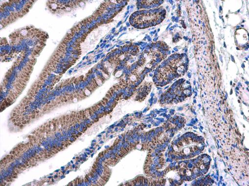 Anti-NDUFAB1 antibody used in IHC (Formalin-fixed paraffin-embedded sections). GTX111875