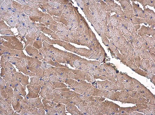 Anti-Olfactomedin-like 3 antibody [N1C1] used in IHC (Formalin-fixed paraffin-embedded sections). GTX119826