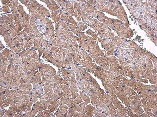Anti-ORNT1 antibody [N1C3-2] used in IHC (Formalin-fixed paraffin-embedded sections). GTX109432