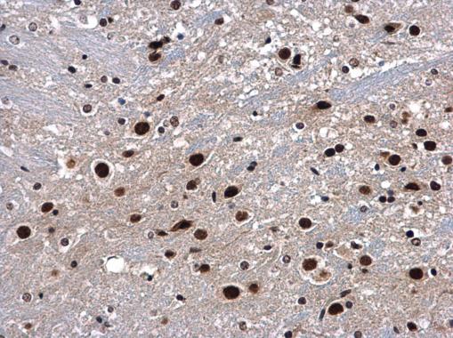 Anti-p54/nrb antibody used in IHC (Formalin-fixed paraffin-embedded sections). GTX101419