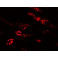 Anti-PEAR1 antibody used in ICC/IF. GTX85138