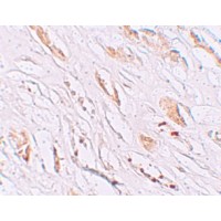 Anti-PEAR1 antibody used in Immunohistochemistry. GTX85138