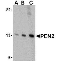 Anti-PEN2 antibody used in Western blot. GTX85064