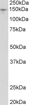 Anti-Pex1 antibody, Internal used in Western blot. GTX88030