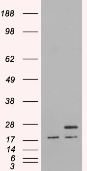 Anti-PGRMC1 / MPR antibody, C-term used in Western blot. GTX89362