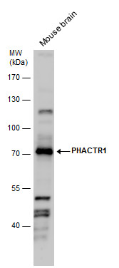 Anti-PHACTR1 antibody used in Western blot. GTX122251
