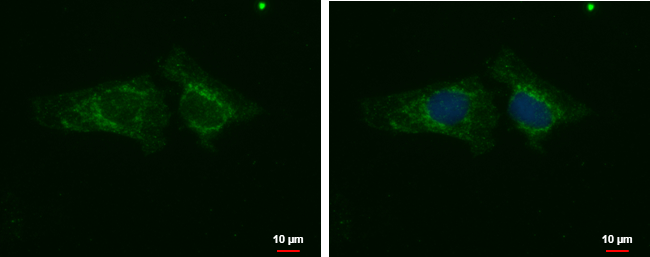 Anti-PHACTR1 antibody used in ICC/IF. GTX122251