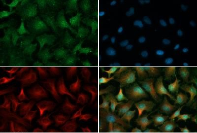 Anti-PHD2 antibody used in ICC/IF. GTX82966