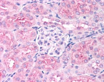 Anti-PHD2 antibody used in Immunohistochemistry. GTX82966