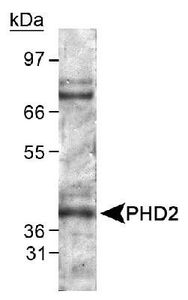 Anti-PHD2 antibody used in Western blot. GTX82966