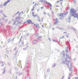Anti-PHLDA2 / IPL antibody, C-term used in IHC (Formalin-fixed paraffin-embedded sections). GTX25964