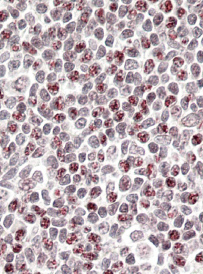 Anti-Phorbolin 1 / APOBEC3A antibody, Internal used in IHC (Formalin-fixed paraffin-embedded sections). GTX88838