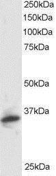 Anti-PI31 / PSMF1 (Isoform 1) antibody, C-term used in Western blot. GTX89875