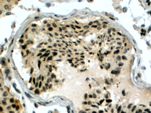Anti-PIR51 / RAD51AP1 antibody, C-term used in IHC (Formalin-fixed paraffin-embedded sections). GTX15957