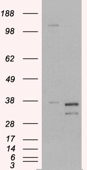 Anti-Pirin antibody, N-term used in Western blot. GTX89691