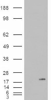 Anti-PLA2G1B antibody, C-term used in Western blot. GTX88948