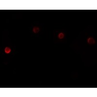 Anti-PLAC1 antibody used in ICC/IF. GTX85151