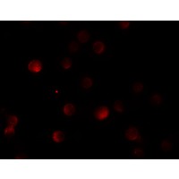 Anti-PLAC3 antibody used in ICC/IF. GTX85150