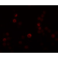 Anti-PLAC4 antibody used in ICC/IF. GTX85149
