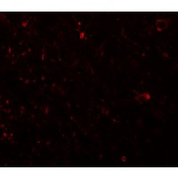 Anti-PLEKHM3 antibody used in ICC/IF. GTX85229