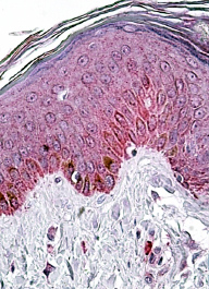 Anti-PNPLA3 / Adiponutrin antibody, Internal used in IHC (Formalin-fixed paraffin-embedded sections). GTX88810