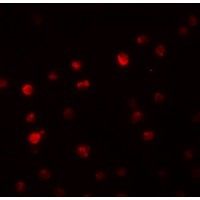 Anti-PPAPDC2 antibody used in ICC/IF. GTX85222