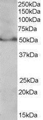 Anti-PPAR delta (Isoform 1) antibody, C-term used in Western blot. GTX89687