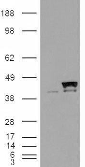 Anti-PPID / CyP-40 antibody, Internal used in Western blot. GTX89009