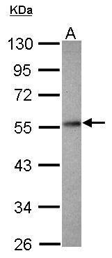 Anti-PPP2R2D antibody [N2C3] used in Western blot. GTX116609