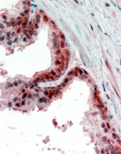 Anti-PPP4C antibody, C-term used in IHC (Formalin-fixed paraffin-embedded sections). GTX88412