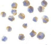 Anti-Precerebellin antibody used in ICC/IF. GTX85500