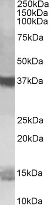 Anti-Prefoldin antibody, C-term used in Western blot. GTX89717