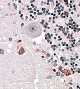 Anti-PRODH antibody, Internal used in IHC (Formalin-fixed paraffin-embedded sections). GTX89352