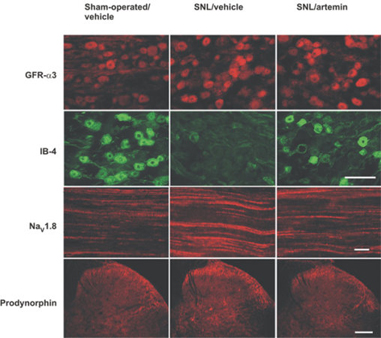 Anti-proDynorphin antibody used in ICC/IF. GTX80766