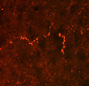 Anti-proDynorphin antibody used in ICC/IF. GTX80766